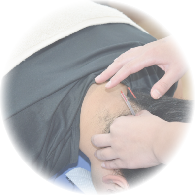 船橋整骨院　鍼灸